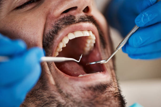 Best Broken or Chipped Tooth Repair in Sterling, VA